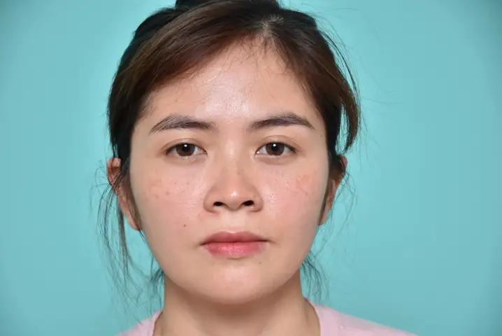 Xem Tướng Mũi Tẹt: Ý Nghĩa Tướng Số, Tính Cách, Vận Mệnh & Cách Khắc Phục Hiệu Quả Xem Tướng Mũi Tẹt: Ý Nghĩa Tướng Số, Tính Cách, Vận Mệnh & Cách Khắc Phục Hiệu Quả