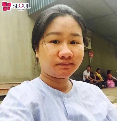 Giải Mã Tướng Mũi To Tròn: Ý Nghĩa Vận Mệnh, Tính Cách Và Tài Lộc Theo Nhân Tướng Học Giải Mã Tướng Mũi To Tròn: Ý Nghĩa Vận Mệnh, Tính Cách Và Tài Lộc Theo Nhân Tướng Học