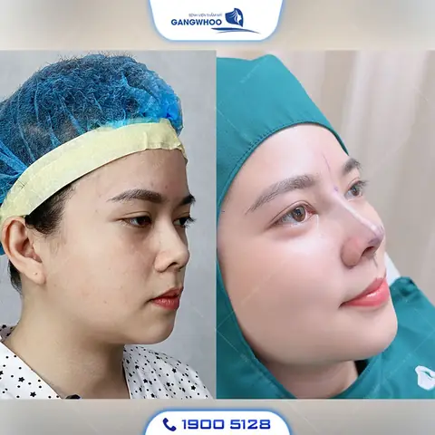 Tổng Hợp Các Tướng Mũi Xấu Ở Phụ Nữ Theo Nhân Tướng Học Và Ý Nghĩa Vận Mệnh Tổng Hợp Các Tướng Mũi Xấu Ở Phụ Nữ Theo Nhân Tướng Học Và Ý Nghĩa Vận Mệnh