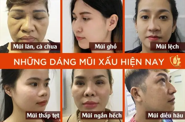 Tổng Hợp Các Tướng Mũi Xấu Ở Phụ Nữ Theo Nhân Tướng Học Và Ý Nghĩa Vận Mệnh Tổng Hợp Các Tướng Mũi Xấu Ở Phụ Nữ Theo Nhân Tướng Học Và Ý Nghĩa Vận Mệnh