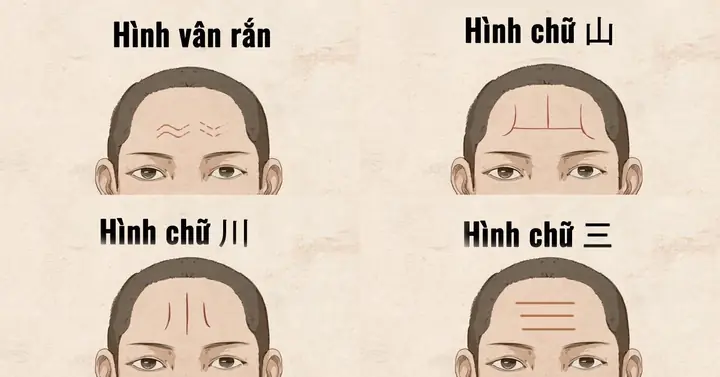 Giải Mã Tướng Nếp Nhăn Trên Trán Đàn Ông Theo Nhân Tướng Học Và Ý Nghĩa Vận Mệnh