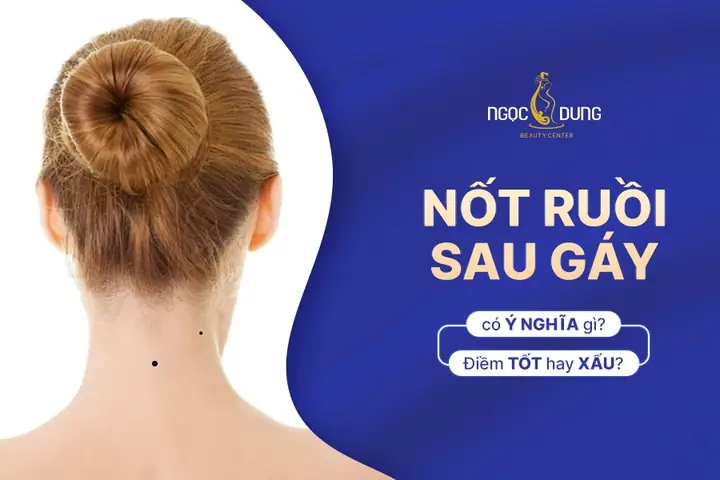 Tướng Người Có Cực U Sau Gáy Là Gì Và Ý Nghĩa Vận Mệnh Theo Nhân Tướng Học