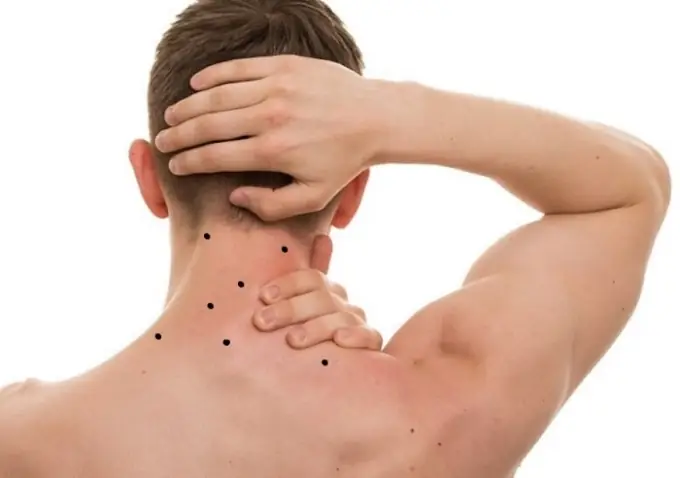 Tướng Người Có Cực U Sau Gáy Là Gì Và Ý Nghĩa Vận Mệnh Theo Nhân Tướng Học