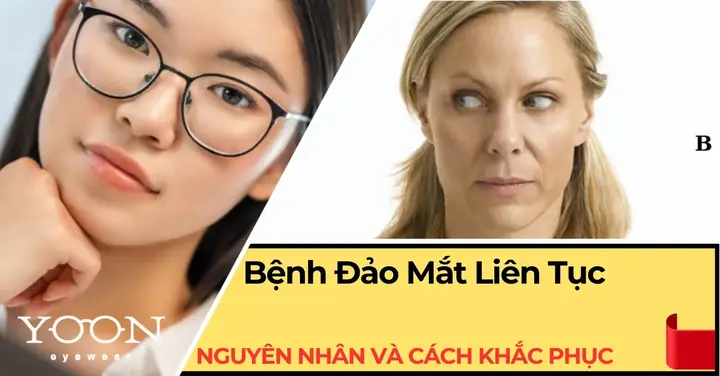 Giải Mã Tướng Người Mắt Đảo Liên Tục Trong Nhân Tướng Học Và Giao Tiếp Giải Mã Tướng Người Mắt Đảo Liên Tục Trong Nhân Tướng Học Và Giao Tiếp