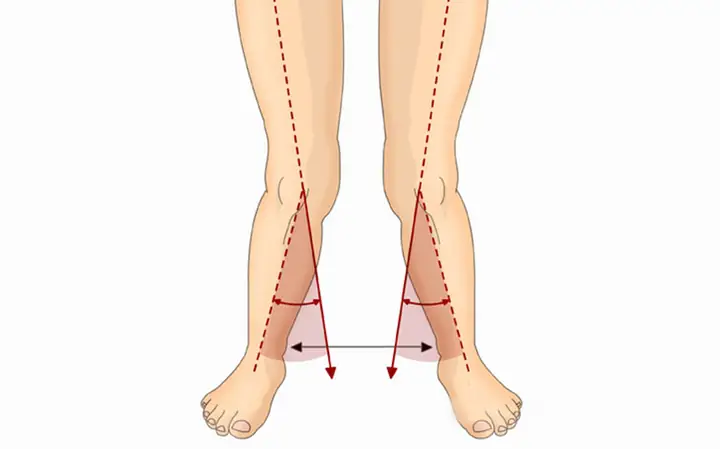 Tướng Phụ Nữ Chân Đi Chữ Bát Là Gì Và Ý Nghĩa Tính Cách Theo Nhân Tướng Học