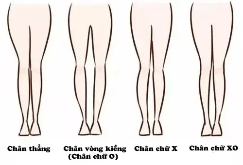 Tướng Phụ Nữ Chân Đi Chữ Bát Là Gì Và Ý Nghĩa Tính Cách Theo Nhân Tướng Học