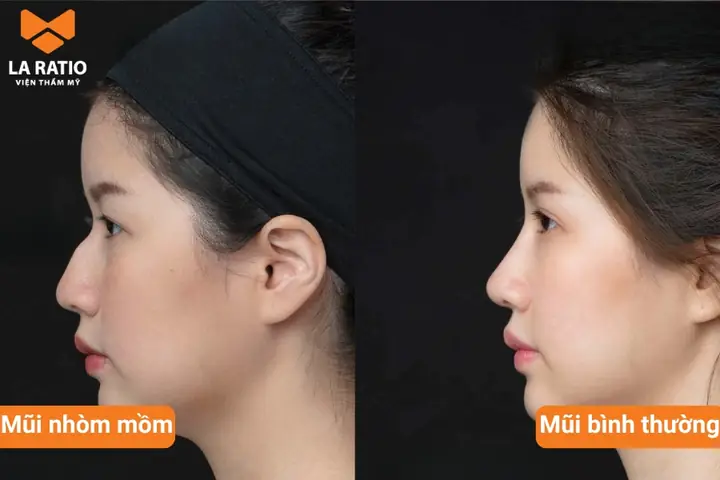Tướng Phụ Nữ Mũi Nhòm Mồm Là Gì Và Đánh Giá Tốt Hay Xấu Theo Nhân Tướng Học Tướng Phụ Nữ Mũi Nhòm Mồm Là Gì Và Đánh Giá Tốt Hay Xấu Theo Nhân Tướng Học