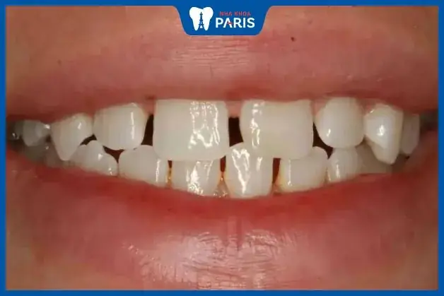 Xem Tướng Răng Phụ Nữ: Giải Mã 9+ Loại Răng Đẹp, Ý Nghĩa Tính Cách & Vận Mệnh Theo Nhân Tướng Học Xem Tướng Răng Phụ Nữ: Giải Mã 9+ Loại Răng Đẹp, Ý Nghĩa Tính Cách & Vận Mệnh Theo Nhân Tướng Học