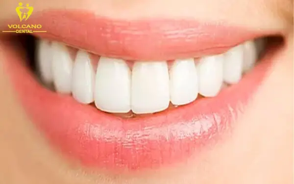 Tướng Răng Trâu Là Gì? Đặc Điểm, Ý Nghĩa Nhân Tướng Học & Vận Mệnh Nam/nữ Chi Tiết Tướng Răng Trâu Là Gì? Đặc Điểm, Ý Nghĩa Nhân Tướng Học & Vận Mệnh Nam/nữ Chi Tiết