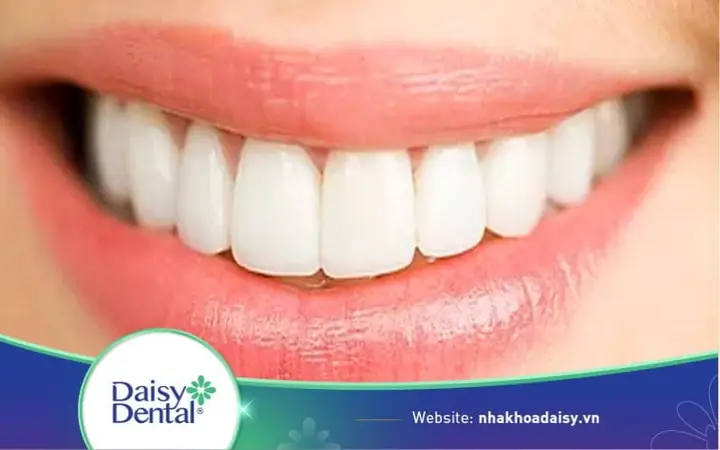 Tướng Răng Trâu Là Gì? Đặc Điểm, Ý Nghĩa Nhân Tướng Học & Vận Mệnh Nam/nữ Chi Tiết Tướng Răng Trâu Là Gì? Đặc Điểm, Ý Nghĩa Nhân Tướng Học & Vận Mệnh Nam/nữ Chi Tiết