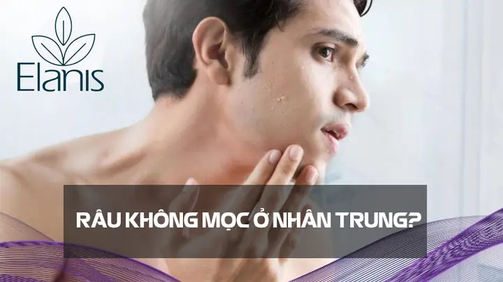 Tìm Hiểu Tướng Râu Không Mọc Ở Nhân Trung: Nguyên Nhân Và Cách Khắc Phục Cho Nam Giới