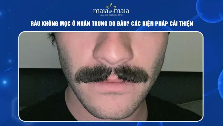 Tìm Hiểu Tướng Râu Không Mọc Ở Nhân Trung: Nguyên Nhân Và Cách Khắc Phục Cho Nam Giới
