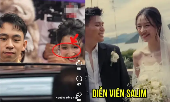 Giải Mã Tướng Râu Mèo Trên Mặt Phụ Nữ: Ý Nghĩa, Đặc Điểm Và Điềm Báo Hôn Nhân Vượng Phu Giải Mã Tướng Râu Mèo Trên Mặt Phụ Nữ: Ý Nghĩa, Đặc Điểm Và Điềm Báo Hôn Nhân Vượng Phu