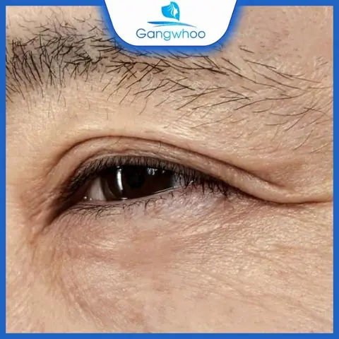 Giải Mã Tướng Số Cho Người Có Mắt 3 Mí: Ý Nghĩa Vận Mệnh Và Tính Cách Theo Giới Tính Giải Mã Tướng Số Cho Người Có Mắt 3 Mí: Ý Nghĩa Vận Mệnh Và Tính Cách Theo Giới Tính