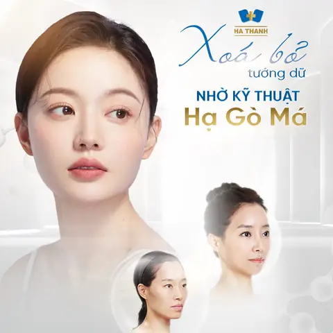Tướng Số Khi Hạ Gò Má: Ý Nghĩa Phong Thủy Và Thay Đổi Nhân Tướng Sau Thẩm Mỹ Tướng Số Khi Hạ Gò Má: Ý Nghĩa Phong Thủy Và Thay Đổi Nhân Tướng Sau Thẩm Mỹ