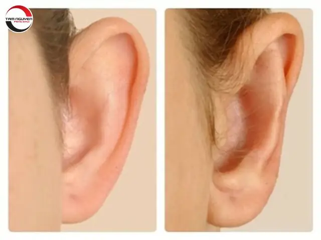 Tướng Số Lỗ Tai: Phân Loại Dáng Tai, Ý Nghĩa Vận Mệnh Và Cách Xem Tài Lộc – Trường Thọ Chi Tiết Tướng Số Lỗ Tai: Phân Loại Dáng Tai, Ý Nghĩa Vận Mệnh Và Cách Xem Tài Lộc – Trường Thọ Chi Tiết