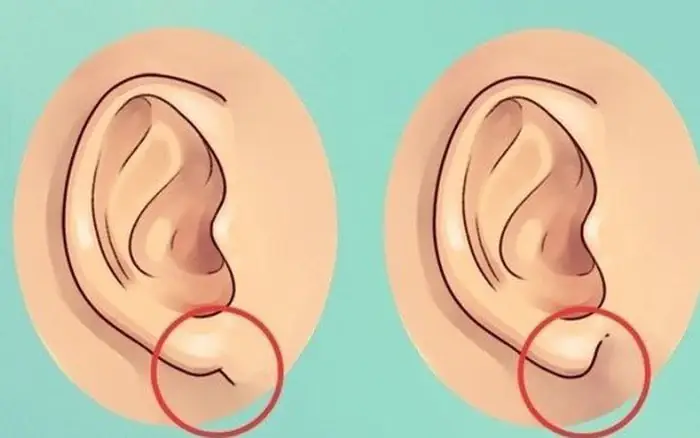 Tướng Số Lỗ Tai: Phân Loại Dáng Tai, Ý Nghĩa Vận Mệnh Và Cách Xem Tài Lộc – Trường Thọ Chi Tiết Tướng Số Lỗ Tai: Phân Loại Dáng Tai, Ý Nghĩa Vận Mệnh Và Cách Xem Tài Lộc – Trường Thọ Chi Tiết