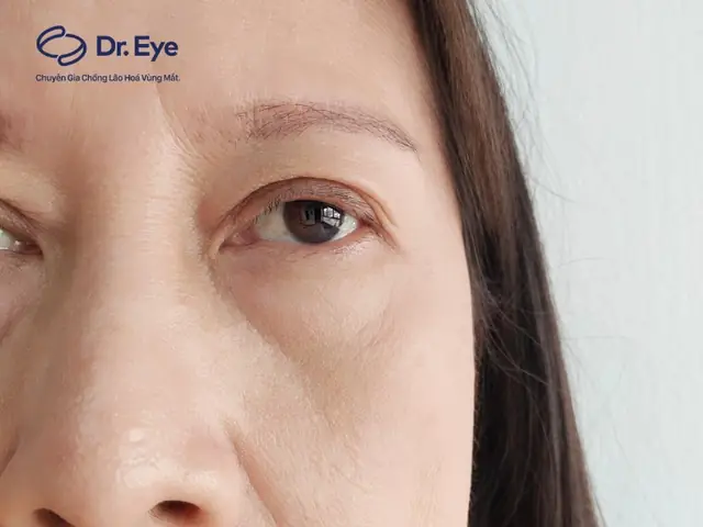 Tướng Số Lông Mày Thưa: Ý Nghĩa Vận Mệnh, Tính Cách Nam Nữ Và Cách Khắc Phục