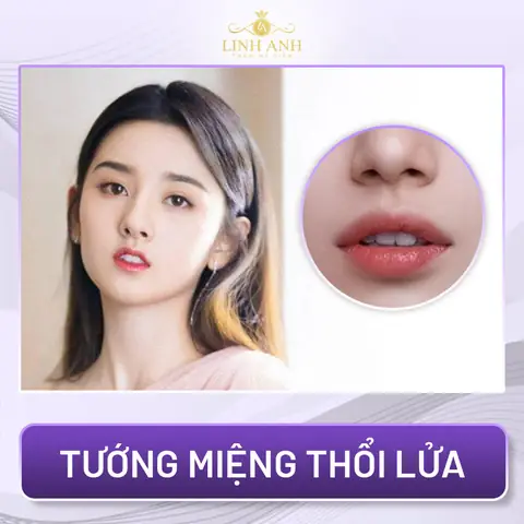 Giải Nghĩa Tướng Số Miệng Méo Bên Trái Và Ý Nghĩa Vận Mệnh, Tính Cách Người Sở Hữu Giải Nghĩa Tướng Số Miệng Méo Bên Trái Và Ý Nghĩa Vận Mệnh, Tính Cách Người Sở Hữu