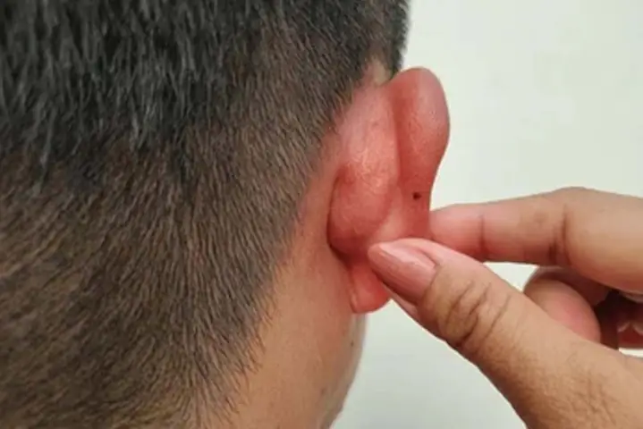 Giải Mã Ý Nghĩa Tướng Số Mụn Ruồi Vành Tai Nam Theo Nhân Tướng Học Giải Mã Ý Nghĩa Tướng Số Mụn Ruồi Vành Tai Nam Theo Nhân Tướng Học