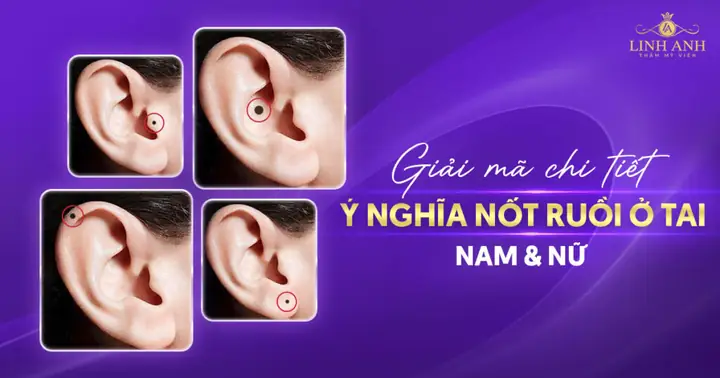 Giải Mã Ý Nghĩa Tướng Số Mụn Ruồi Vành Tai Nam Theo Nhân Tướng Học Giải Mã Ý Nghĩa Tướng Số Mụn Ruồi Vành Tai Nam Theo Nhân Tướng Học