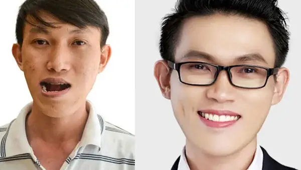 Giải Nghĩa Tướng Số Người Mặt Lưỡi Cày: Tính Cách, Vận Mệnh Và Cách Khắc Phục Giải Nghĩa Tướng Số Người Mặt Lưỡi Cày: Tính Cách, Vận Mệnh Và Cách Khắc Phục