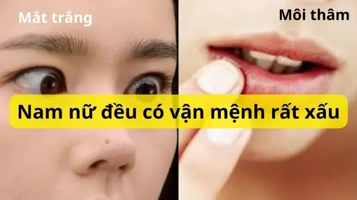 Giải Mã Tướng Số Người Mắt Thâm: Ý Nghĩa Nhân Tượng, Thực Hư "số Khổ" Và Nguyên Nhân Y Khoa Giải Mã Tướng Số Người Mắt Thâm: Ý Nghĩa Nhân Tượng, Thực Hư "số Khổ" Và Nguyên Nhân Y Khoa