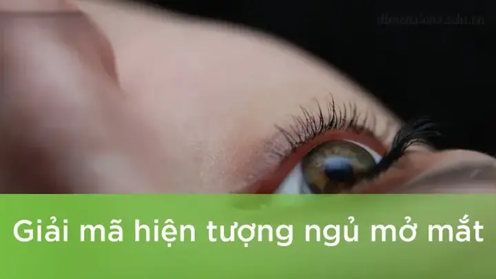 Giải Mã Tướng Số Người Ngủ Mở Mắt: Nhân Tướng Học Và Bệnh Lý Liên Quan Giải Mã Tướng Số Người Ngủ Mở Mắt: Nhân Tướng Học Và Bệnh Lý Liên Quan
