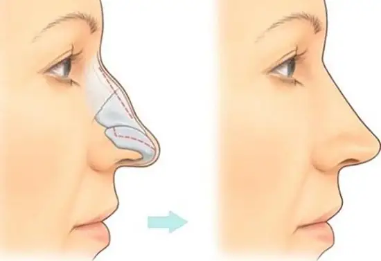 Hướng Dẫn Xem Tướng Số Qua Mũi: Giải Mã 3 Bộ Phận & Ý Nghĩa Các Dáng Mũi Đẹp - Xấu Hướng Dẫn Xem Tướng Số Qua Mũi: Giải Mã 3 Bộ Phận & Ý Nghĩa Các Dáng Mũi Đẹp - Xấu