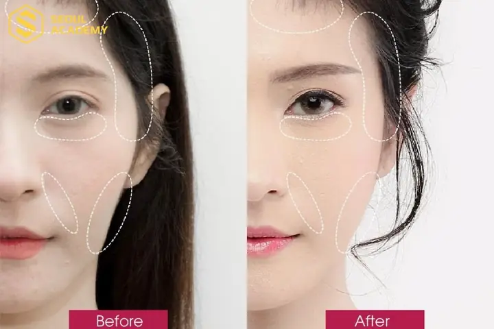Xem Tướng Tai Chuột Nữ: Ý Nghĩa, Tính Cách, Vận Mệnh Và Cách Khắc Phục Chi Tiết Xem Tướng Tai Chuột Nữ: Ý Nghĩa, Tính Cách, Vận Mệnh Và Cách Khắc Phục Chi Tiết