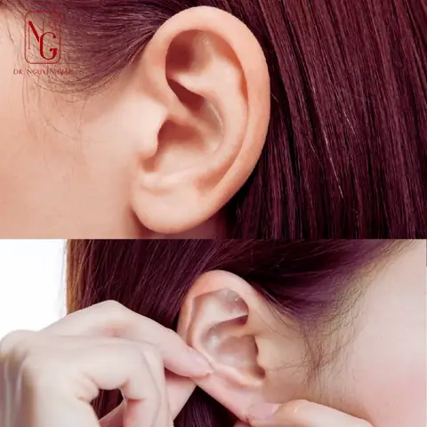 Giải Mã Tướng Tai Lật Vành Nam: Nhận Diện, Tính Cách Và Vận Mệnh Giàu Sang Hay Vất Vả Giải Mã Tướng Tai Lật Vành Nam: Nhận Diện, Tính Cách Và Vận Mệnh Giàu Sang Hay Vất Vả