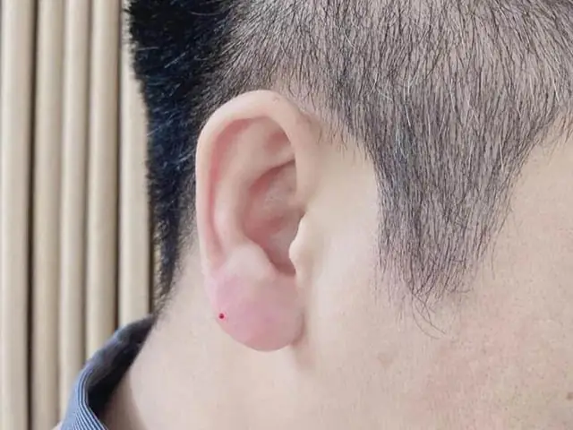 Tướng Tai Phật Là Gì? Đặc Điểm, Ý Nghĩa Vận Mệnh Nam Nữ & Có Tốt Hay Xấu?