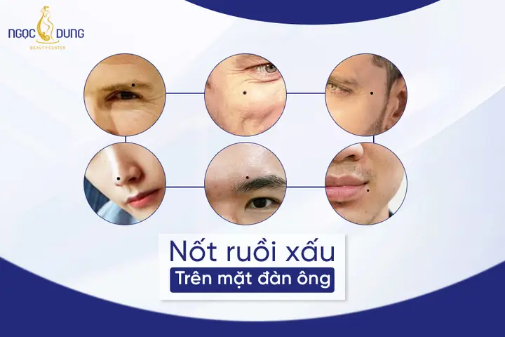 Giải Mã Ý Nghĩa Vị Trí Nốt Ruồi Của Đàn Ông Theo Nhân Tướng Học Và Phong Thủy Giải Mã Ý Nghĩa Vị Trí Nốt Ruồi Của Đàn Ông Theo Nhân Tướng Học Và Phong Thủy