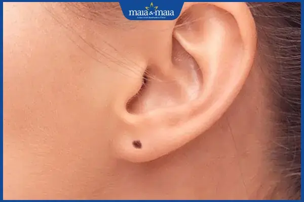Giải Mã Ý Nghĩa Vị Trí Nốt Ruồi Đỏ Ở Tai Theo Nhân Tướng Học Cho Nam Và Nữ Giải Mã Ý Nghĩa Vị Trí Nốt Ruồi Đỏ Ở Tai Theo Nhân Tướng Học Cho Nam Và Nữ