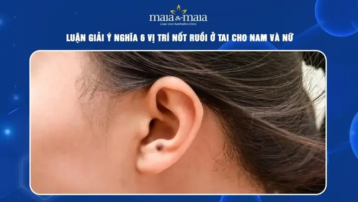 Giải Mã Ý Nghĩa Vị Trí Nốt Ruồi Đỏ Ở Tai Theo Nhân Tướng Học Cho Nam Và Nữ Giải Mã Ý Nghĩa Vị Trí Nốt Ruồi Đỏ Ở Tai Theo Nhân Tướng Học Cho Nam Và Nữ