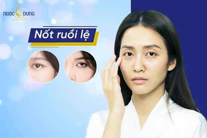 Giải Mã Ý Nghĩa Phong Thủy Nốt Ruồi Đón Lệ Ở Nam Và Nữ Theo Nhân Tướng Học Giải Mã Ý Nghĩa Phong Thủy Nốt Ruồi Đón Lệ Ở Nam Và Nữ Theo Nhân Tướng Học