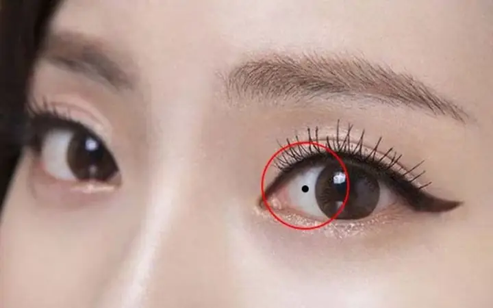 Tổng Hợp Các Vị Trí Nốt Ruồi Lận Đận Tình Duyên Trên Khuôn Mặt Phụ Nữ Và Cách Nhận Biết