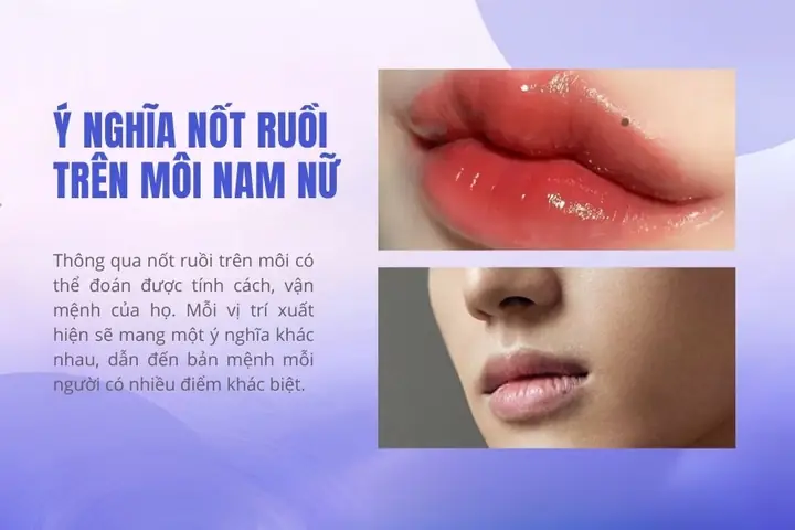 Giải Mã Ý Nghĩa Vị Trí Nốt Ruồi Ở Môi Theo Từng Khu Vực Cho Nam Và Nữ