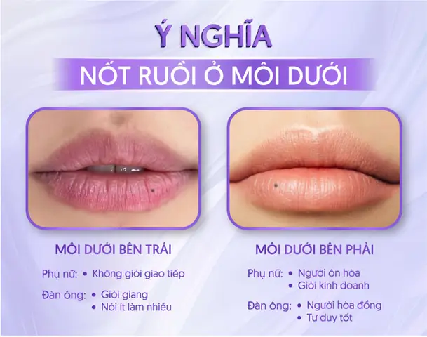 Giải Mã Ý Nghĩa Vị Trí Nốt Ruồi Ở Môi Theo Từng Khu Vực Cho Nam Và Nữ