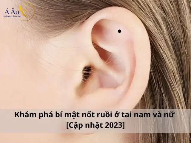 Giải Mã Ý Nghĩa Vị Trí Nốt Ruồi Ở Tai Theo Nhân Tướng Học Cho Nam Và Nữ