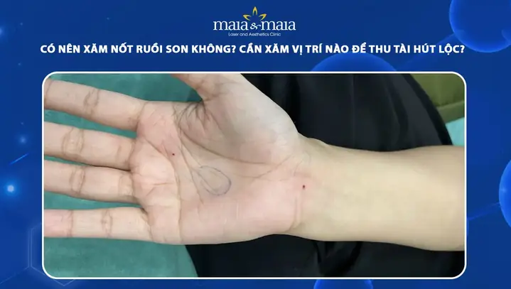 Tổng Hợp Vị Trí Nốt Ruồi Son May Mắn Trên Cơ Thể Theo Nhân Tướng Học