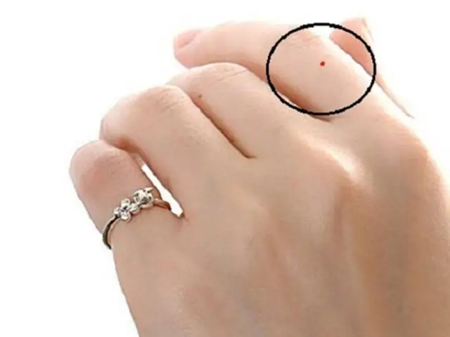 Tổng Hợp Vị Trí Nốt Ruồi Son May Mắn Trên Cơ Thể Theo Nhân Tướng Học
