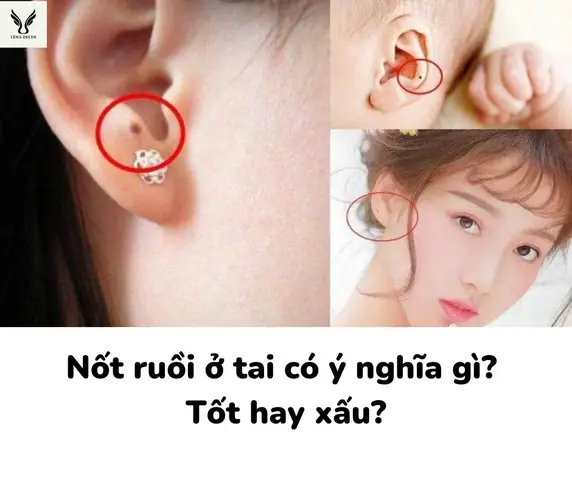 Giải Mã Ý Nghĩa Nốt Ruồi Trên Tai Theo Nhân Tướng Học Cho Nam Và Nữ
