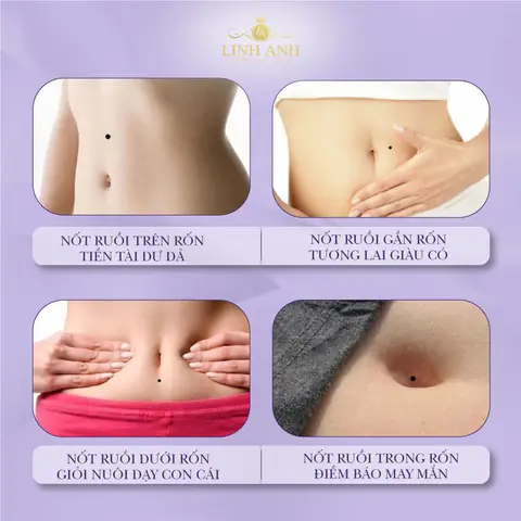 Giải Mã Ý Nghĩa Vị Trí Nốt Ruồi Trên Bụng Phụ Nữ Theo Nhân Tướng Học Giải Mã Ý Nghĩa Vị Trí Nốt Ruồi Trên Bụng Phụ Nữ Theo Nhân Tướng Học