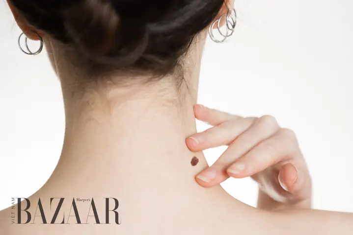 Giải Mã Ý Nghĩa Nốt Ruồi Trên Lưng Phụ Nữ: Tốt Hay Xấu Và Có Nên Xóa? Giải Mã Ý Nghĩa Nốt Ruồi Trên Lưng Phụ Nữ: Tốt Hay Xấu Và Có Nên Xóa?