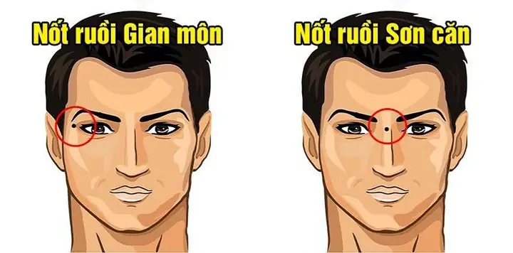 Giải Mã Ý Nghĩa Vị Trí Nốt Ruồi Trên Mặt Đàn Ông Theo Nhân Tướng Học
