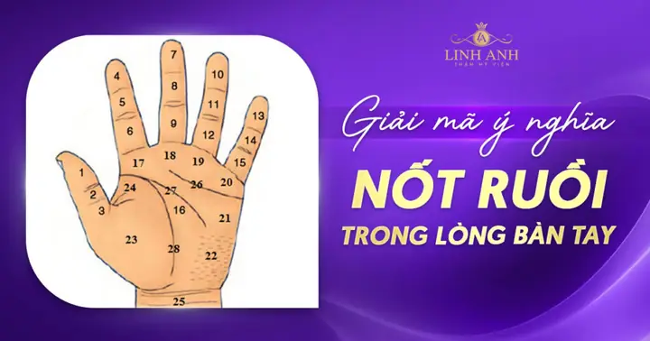 Giải Mã Vị Trí Nốt Ruồi Trong Lòng Bàn Tay Theo Nhân Tướng Học Và Khoa Học Giải Mã Vị Trí Nốt Ruồi Trong Lòng Bàn Tay Theo Nhân Tướng Học Và Khoa Học