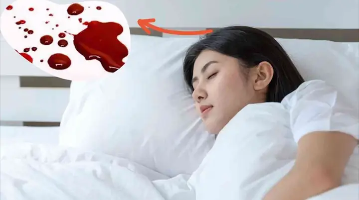 Giải Mã Giấc Mơ Thấy Máu: Ý Nghĩa, Điềm Lành Hay Dữ Và Cách Ứng Phó Giải Mã Giấc Mơ Thấy Máu: Ý Nghĩa, Điềm Lành Hay Dữ Và Cách Ứng Phó