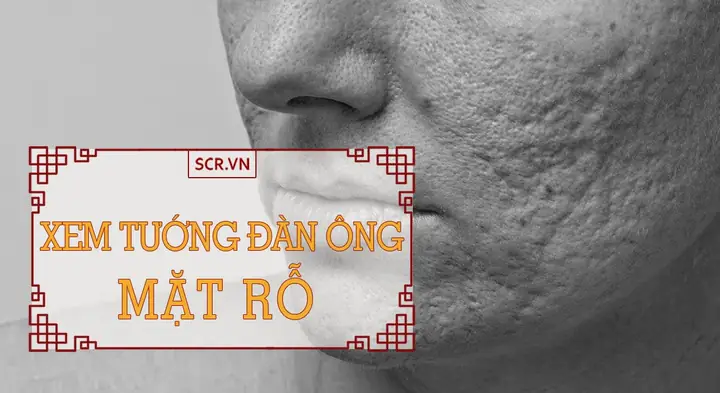 Xem Tướng Đàn Ông Mặt Rỗ: Ý Nghĩa Vận Mệnh Theo Nhân Tướng Học Xem Tướng Đàn Ông Mặt Rỗ: Ý Nghĩa Vận Mệnh Theo Nhân Tướng Học