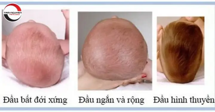 Xem Tướng Đầu: Hướng Dẫn Nhận Biết Vận Mệnh, Tính Cách Qua Hình Dáng Và Đặc Điểm Khuôn Mặt Xem Tướng Đầu: Hướng Dẫn Nhận Biết Vận Mệnh, Tính Cách Qua Hình Dáng Và Đặc Điểm Khuôn Mặt